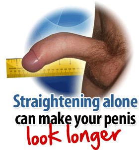 sizegenetics penis straightener device